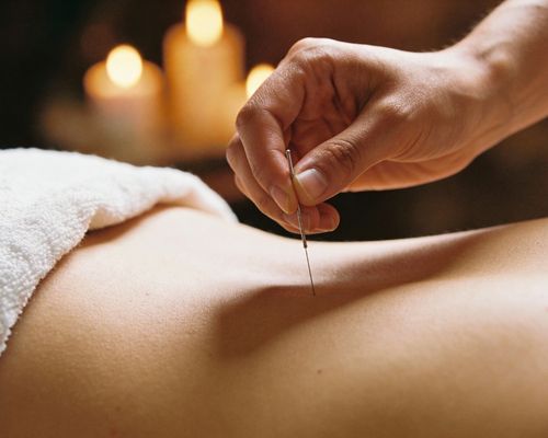 Agendamento Online para Acupuntura